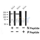 AF7415 at 1/100 staining human liver tissue sections by IHC-P. The tissue was formaldehyde fixed and a heat mediated antigen retrieval step in citrate buffer was performed. The tissue was then blocked and incubated with the antibody for 1.5 hours at 22¡ãC. An HRP conjugated goat anti-rabbit antibody was used as the secondary