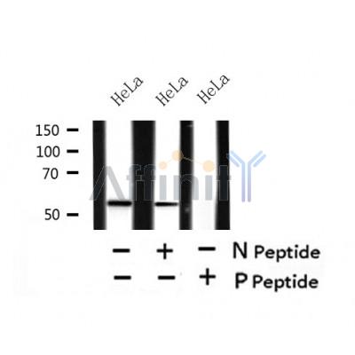 AF7419 at 1/100 staining human gastric cancer tissue sections by IHC-P. The tissue was formaldehyde fixed and a heat mediated antigen retrieval step in citrate buffer was performed. The tissue was then blocked and incubated with the antibody for 1.5 hours at 22¡ãC. An HRP conjugated goat anti-rabbit antibody was used as the secondary