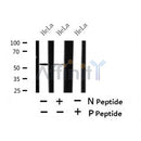 AF7420 at 1/100 staining human gastric cancer tissue sections by IHC-P. The tissue was formaldehyde fixed and a heat mediated antigen retrieval step in citrate buffer was performed. The tissue was then blocked and incubated with the antibody for 1.5 hours at 22¡ãC. An HRP conjugated goat anti-rabbit antibody was used as the secondary