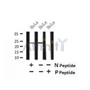 AF7422 at 1/100 staining rat lung tissue sections by IHC-P. The tissue was formaldehyde fixed and a heat mediated antigen retrieval step in citrate buffer was performed. The tissue was then blocked and incubated with the antibody for 1.5 hours at 22¡ãC. An HRP conjugated goat anti-rabbit antibody was used as the secondary