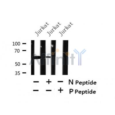 AF7423 at 1/100 staining rat lung tissue sections by IHC-P. The tissue was formaldehyde fixed and a heat mediated antigen retrieval step in citrate buffer was performed. The tissue was then blocked and incubated with the antibody for 1.5 hours at 22¡ãC. An HRP conjugated goat anti-rabbit antibody was used as the secondary