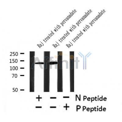 Western blot analysis of Phospho-SHIP1 (Tyr865) in lysates of Raj treated with pervanadate, using Phospho-SHIP1 (Tyr865) Antibody(AF7426).
