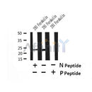 AF7427 at 1/100 staining mouse kidney tissue sections by IHC-P. The tissue was formaldehyde fixed and a heat mediated antigen retrieval step in citrate buffer was performed. The tissue was then blocked and incubated with the antibody for 1.5 hours at 22¡ãC. An HRP conjugated goat anti-rabbit antibody was used as the secondary