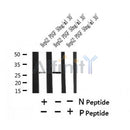 AF7429 at 1/100 staining mouse kidney tissue sections by IHC-P. The tissue was formaldehyde fixed and a heat mediated antigen retrieval step in citrate buffer was performed. The tissue was then blocked and incubated with the antibody for 1.5 hours at 22¡ãC. An HRP conjugated goat anti-rabbit antibody was used as the secondary