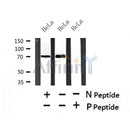 Western blot analysis of Phospho-Myt1 (Ser120) in lysates of HeLa?, using Phospho-Myt1 (Ser120) Antibody(AF7435).