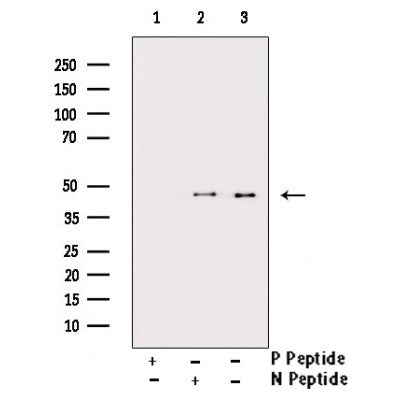 AF3243 staining K562 by IF/ICC. The sample were fixed with PFA and permeabilized in 0.1% Triton X-100,then blocked in 10% serum for 45 minutes at 25¡ãC. The primary antibody was diluted at 1/200 and incubated with the sample for 1 hour at 37¡ãC. An  Alexa Fluor 594 conjugated goat anti-rabbit IgG (H+L) Ab, diluted at 1/600, was used as the secondary antibod