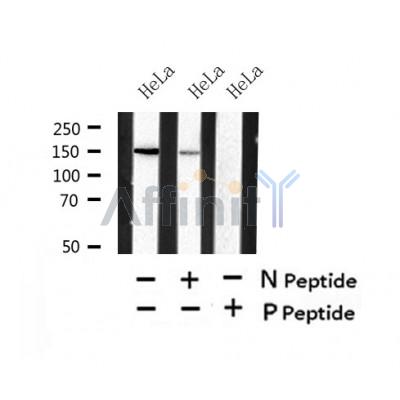 Western blot analysis of Phospho-LATS2 (Ser827) in lysates of HeLa?, using Phospho-LATS2 (Ser827) Antibody(AF7440).