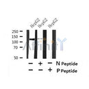 Western blot analysis of Phospho-perk (Ser555) in lysates of HepG2?, using Phospho-perk (Ser555) Antibody(AF7441).