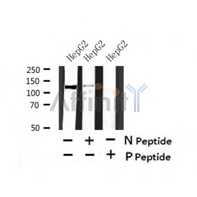 Western blot analysis of Phospho-perk (Ser555) in lysates of HepG2?, using Phospho-perk (Ser555) Antibody(AF7441).
