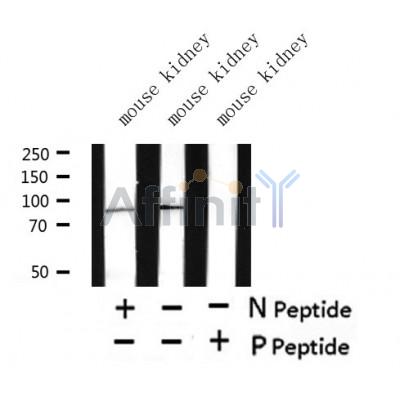 Western blot analysis of extracts of mouse kidney? tissue sample,using Phospho-Nephrin(Tyr1176) Antibody?.