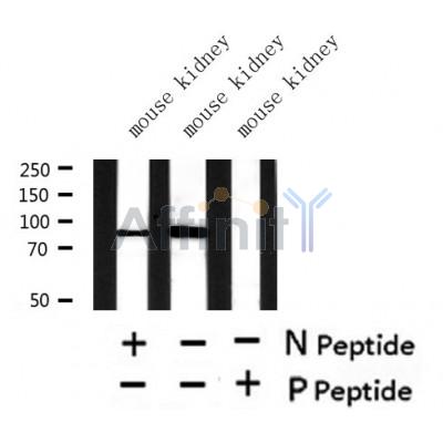 Western blot analysis of extracts of mouse kidney? tissue sample,using Phospho-Nephrin(Ser432) Antibody?.