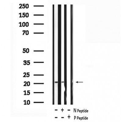 AF7453 at 1/100 staining human liver tissue sections by IHC-P. The tissue was formaldehyde fixed and a heat mediated antigen retrieval step in citrate buffer was performed. The tissue was then blocked and incubated with the antibody for 1.5 hours at 22¡ãC. An HRP conjugated goat anti-rabbit antibody was used as the secondary
