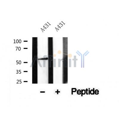Western blot analysis of N-WASP in lysates of A431?, using N-WASP Antibody(AF7532).