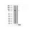 Western blot analysis of SKI in lysates of Jurkat, using SKI Antibody(AF7536).