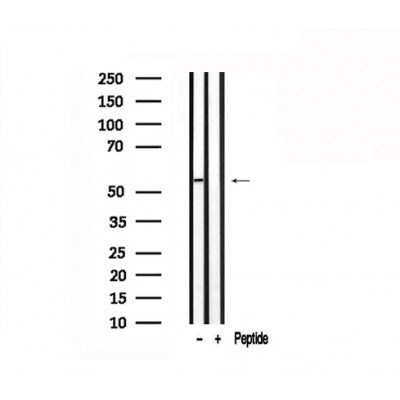 Western blot analysis of extracts of Mouse pancreas? tissue sample,using SLC16A1 Antibody(AF7544).