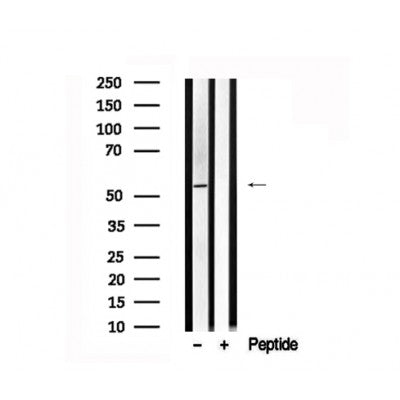 Western blot analysis of HNF1A in lysates of HepG2?, using HNF1A Antibody(AF7545).