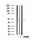 Western blot analysis of TTF1 in lysates of HeLa?, using TTF1 Antibody(AF7547).