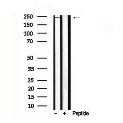 Western blot analysis of NOTCH3 in lysates of K562?, using NOTCH3 Antibody(AF7548).