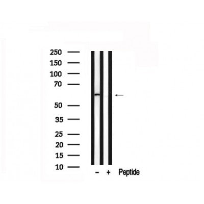 Western blot analysis of SLC22A8 in lysates of fetal heart?, using SLC22A8 Antibody(AF7549).