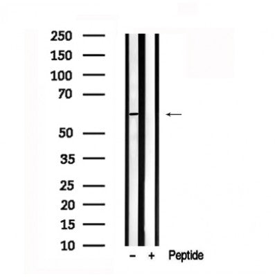 Western blot analysis of SLC32A1 in lysates of PANC1, using SLC32A1 Antibody(AF7551).