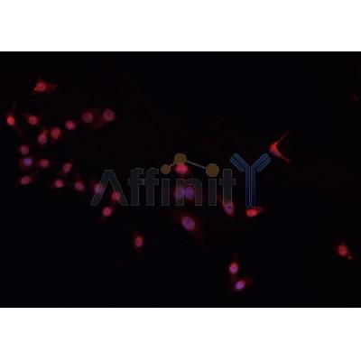 AF0225 staining Daudi cells by IF/ICC. The sample were fixed with PFA and permeabilized in 0.1% Triton X-100,then blocked in 10% serum for 45 minutes at 25¡ãC. The primary antibody was diluted at 1/200 and incubated with the sample for 1 hour at 37¡ãC. An  Alexa Fluor 594 conjugated goat anti-rabbit IgG (H+L) antibody(Cat.