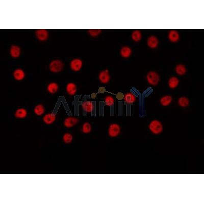 AF0225 staining COS7 by IF/ICC. The sample were fixed with PFA and permeabilized in 0.1% Triton X-100,then blocked in 10% serum for 45 minutes at 25¡ãC. The primary antibody was diluted at 1/200 and incubated with the sample for 1 hour at 37¡ãC. An  Alexa Fluor 594 conjugated goat anti-rabbit IgG (H+L) Ab, diluted at 1/600, was used as the secondary antibod