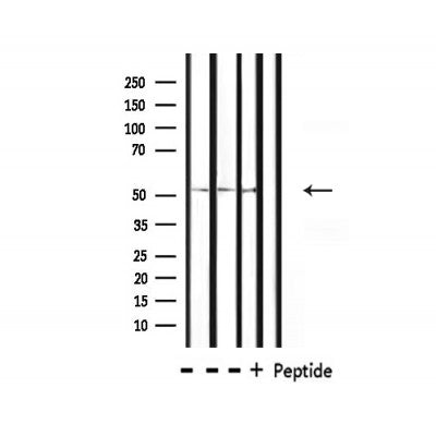 Western blot analysis of extracts from HepG2, mouse spleen, rat liver , using OCT2 Antibody.The lane on the right is treated with the antigen-specific peptide.