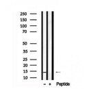 Western blot analysis of FABP1 in lysates of HepG2?, using FABP1 Antibody(AF7555).