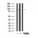 Western blot analysis of extracts of Mouse kidney tissue sample,using ADAM9 Antibody(AF7559).