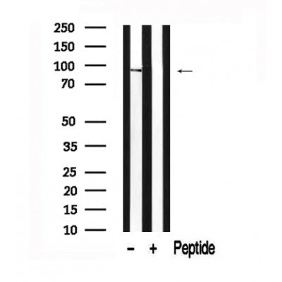 Western blot analysis of extracts of Mouse kidney tissue sample,using ADAM9 Antibody(AF7559).