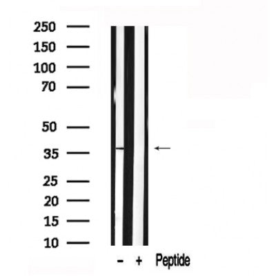 Western blot analysis of extracts of Mouse kidney tissue sample,using FBP1 Antibody(AF7560).