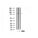 Western blot analysis of PFKM in lysates of HeLa?, using PFKM Antibody(AF7562).