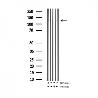 AF3248 staining K562 by IF/ICC. The sample were fixed with PFA and permeabilized in 0.1% Triton X-100,then blocked in 10% serum for 45 minutes at 25¡ãC. The primary antibody was diluted at 1/200 and incubated with the sample for 1 hour at 37¡ãC. An  Alexa Fluor 594 conjugated goat anti-rabbit IgG (H+L) Ab, diluted at 1/600, was used as the secondary antibod