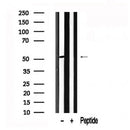 Western blot analysis of FKBP4 in lysates of Jurkat, using FKBP4 Antibody(AF7565).