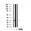 Western blot analysis of HPRT1 in lysates of HeLa, using HPRT1 Antibody(AF7567).
