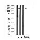 Western blot analysis of GLI2 in lysates of HeLa?, using GLI2 Antibody(AF7572).