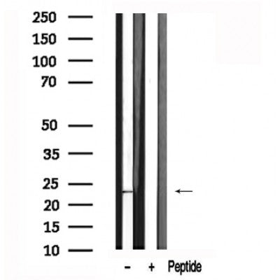Western blot analysis of HES1 in lysates of A431, using HES1 Antibody(AF7575).