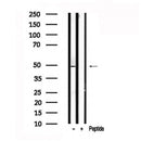 Western blot analysis of CASP2 in lysates of Jurkat , using CASP2 Antibody(AF7578).
