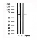 Western blot analysis of PINK1 in lysates of Jurkat?, using PINK1 Antibody(AF7581).