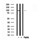 Western blot analysis of LPIN1 in lysates of K562?, using LPIN1 Antibody(AF7585).