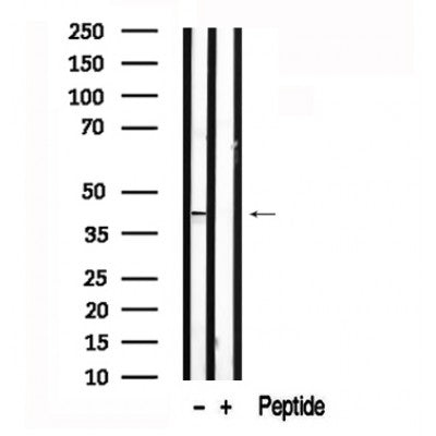 Western blot analysis of ATG3 in lysates of Jurkat , using ATG3 Antibody(AF7587).