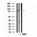 Western blot analysis of RIPK1 in lysates of HeLa?, using RIPK1 Antibody(AF7588).