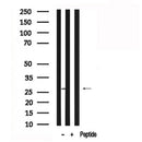 Western blot analysis of CDC34 in lysates of RAW 264.7?, using CDC34 Antibody(AF7590).