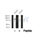 Western blot analysis of CTNNAL1 in lysates of HepG2?, using CTNNAL1 Antibody(AF7592).