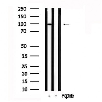 Western blot analysis of extracts of Human placenta tissue sample,using ARHGAP42 Antibody(AF7594).