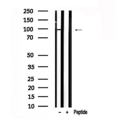 Western blot analysis of extracts of Human placenta tissue sample,using ARHGAP42 Antibody(AF7595).