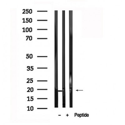 Western blot analysis of PDCD5 in lysates of HeLa?, using PDCD5 Antibody(AF7602).