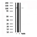Western blot analysis of PLD2 in lysates of Jurkat , using PLD2 Antibody(AF7603).
