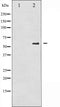 AF3252 staining HeLa by IF/ICC. The sample were fixed with PFA and permeabilized in 0.1% Triton X-100,then blocked in 10% serum for 45 minutes at 25¡ãC. The primary antibody was diluted at 1/200 and incubated with the sample for 1 hour at 37¡ãC. An  Alexa Fluor 594 conjugated goat anti-rabbit IgG (H+L) Ab, diluted at 1/600, was used as the secondary antibod