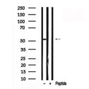 Western blot analysis of MDM4 in lysates of HeLa , using MDM4 Antibody(AF7610).